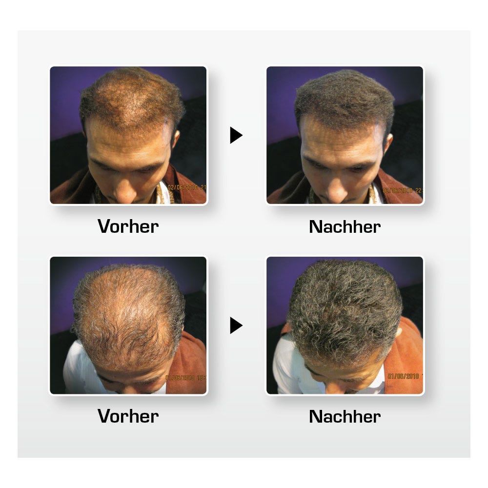 BioThik Haaraufbau-Faser S1 schwarz 25 g