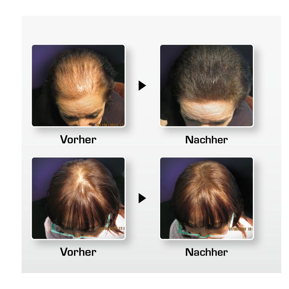 BioThik Haaraufbau-Faser S1 schwarz 25 g