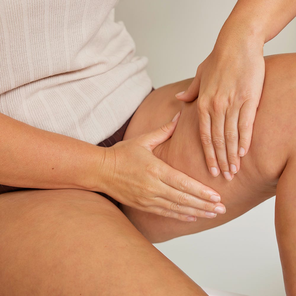 Weleda Birke Cellulite-Öl