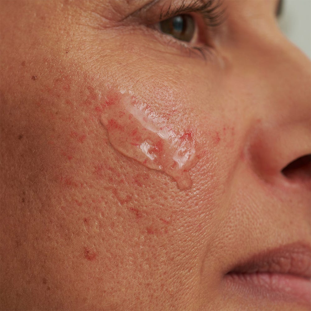 DADO SENS SENSACEA Intensivserum 50 ml