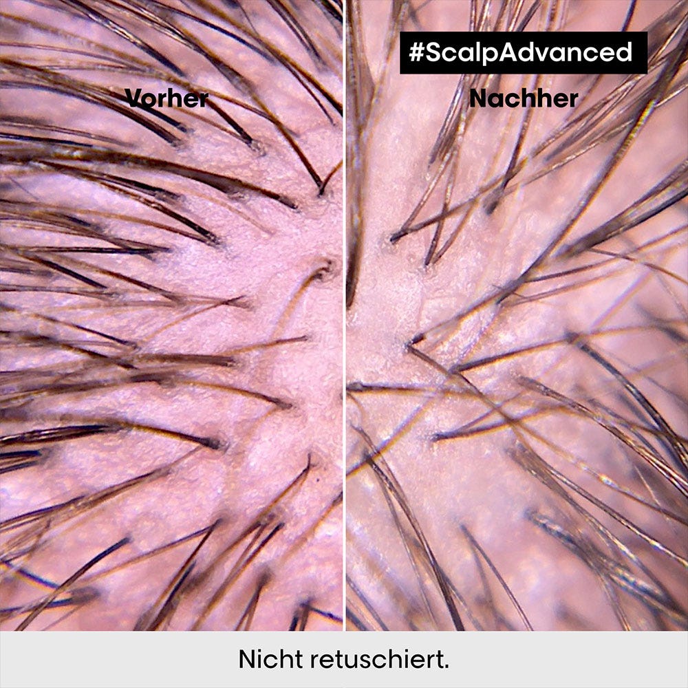 L'Oréal Professionnel Paris Série Expert Scalp Advanced Anti-Discomfort Intese Soother Treatment 200 ml