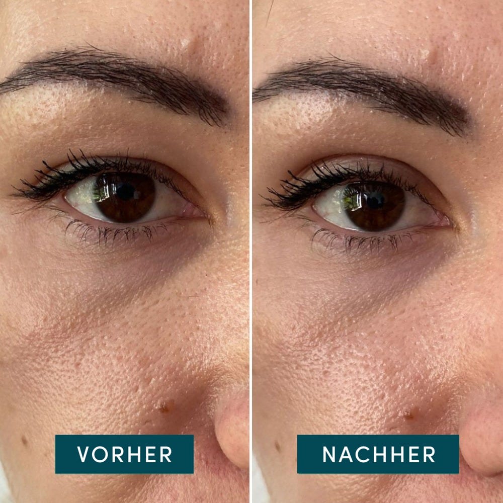 APRICOT Eyelid Lifting Tapes 96 Stück