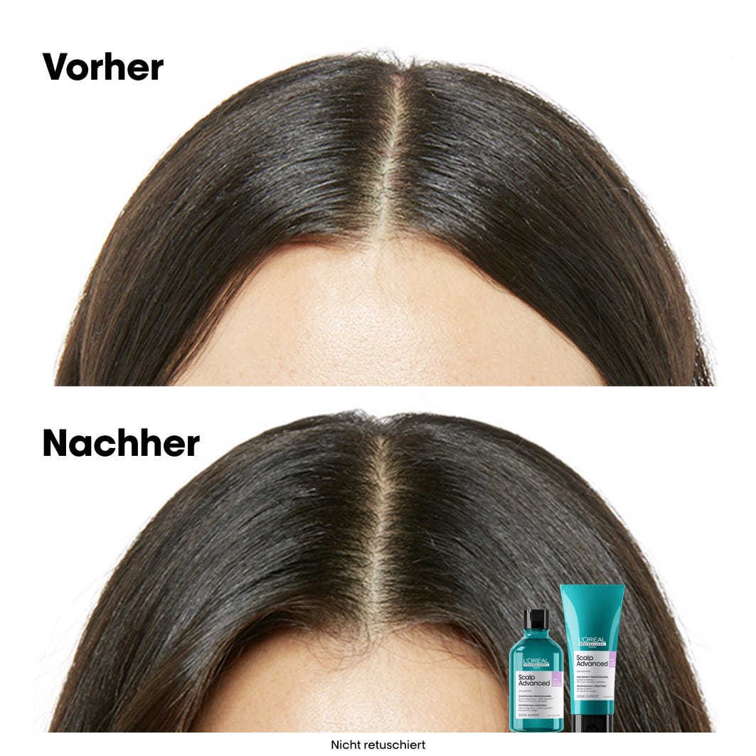 L'Oréal Professionnel Paris Série Expert Scalp Advanced Anti-Discomfort Dermo-Regulator Shampoo Refill 500 ml