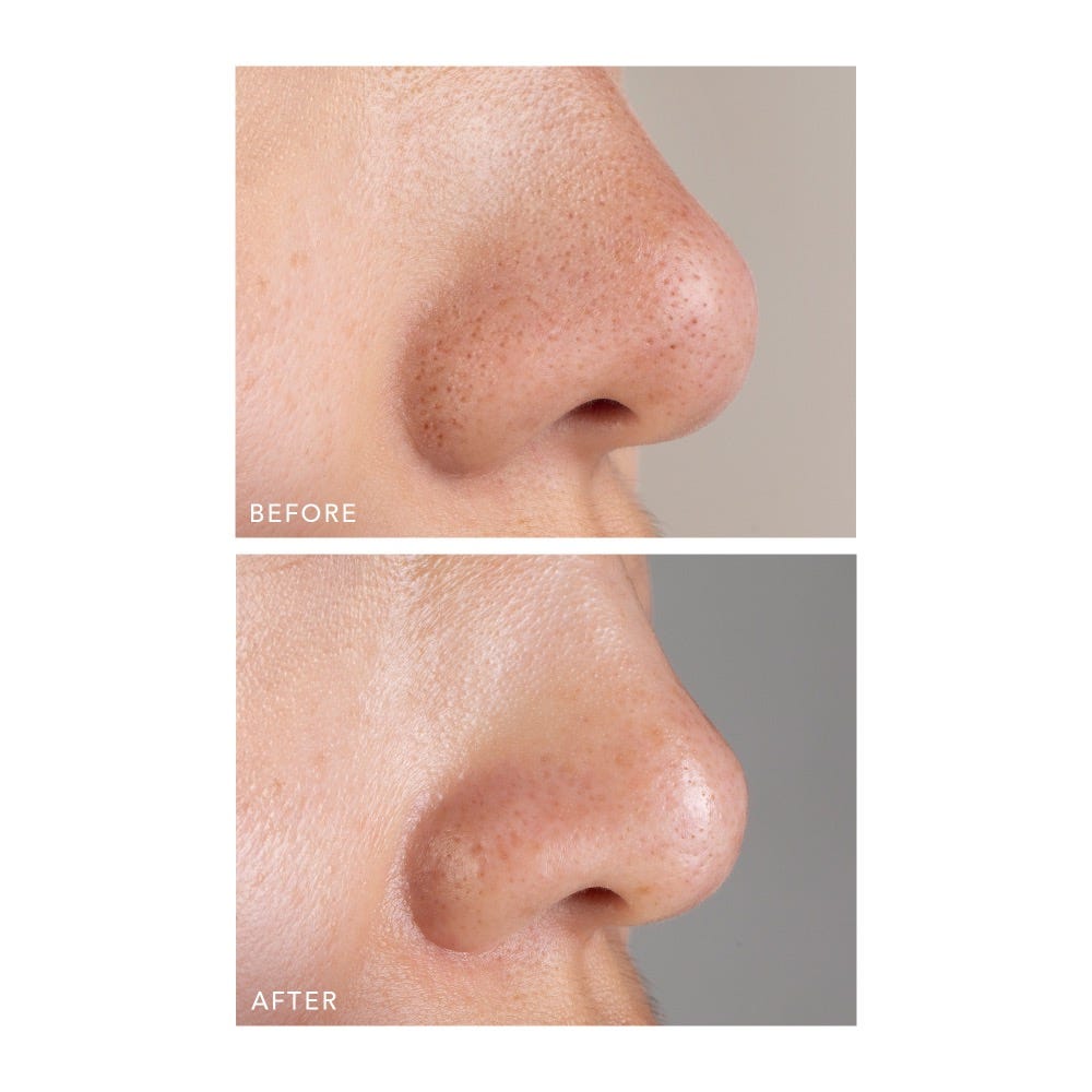FOREO Sweden KIWI Active Pore & Blackhead Mask 100 g