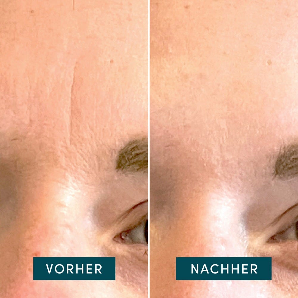 APRICOT Baumwoll-Gesichtspflaster mit Hyaluron 24 Stück