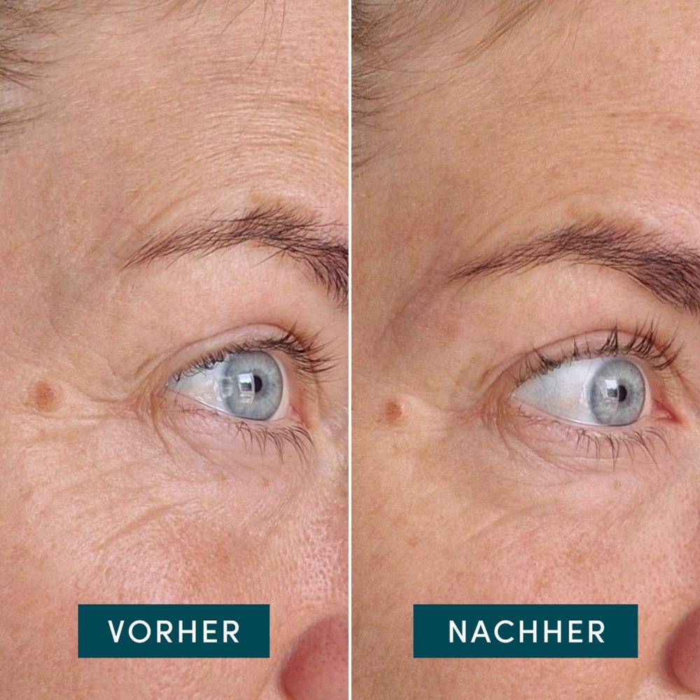 APRICOT Wiederverwendbare Augen-Schläfen Pads mit Ectoin