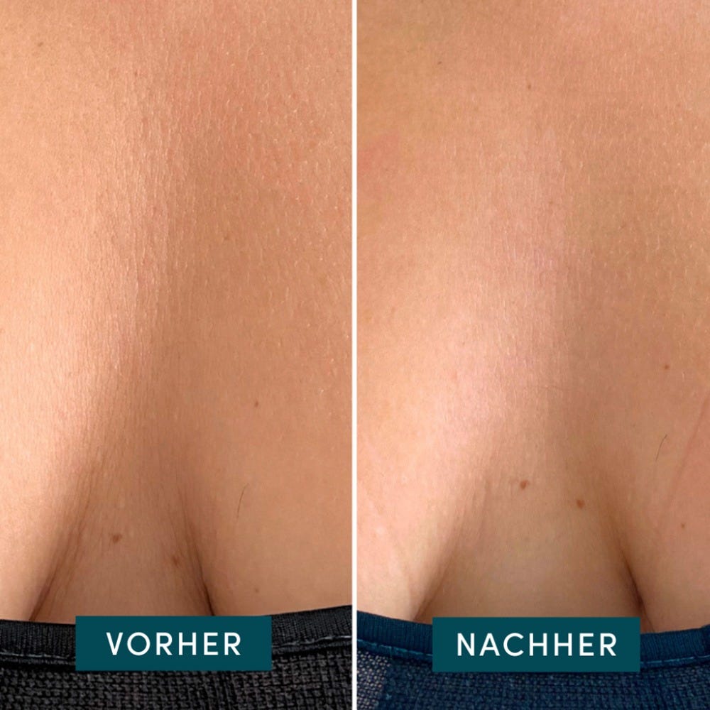 Apricot Wiederverwendbares Dekolleté Pad mit Ectoin