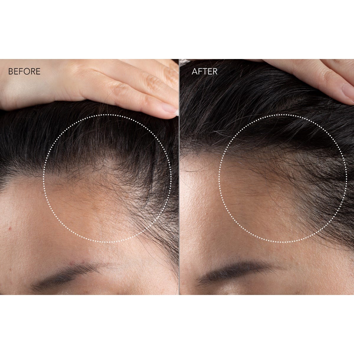 FAQ Swiss 301 LED Hair Strengthening Scalp Massager