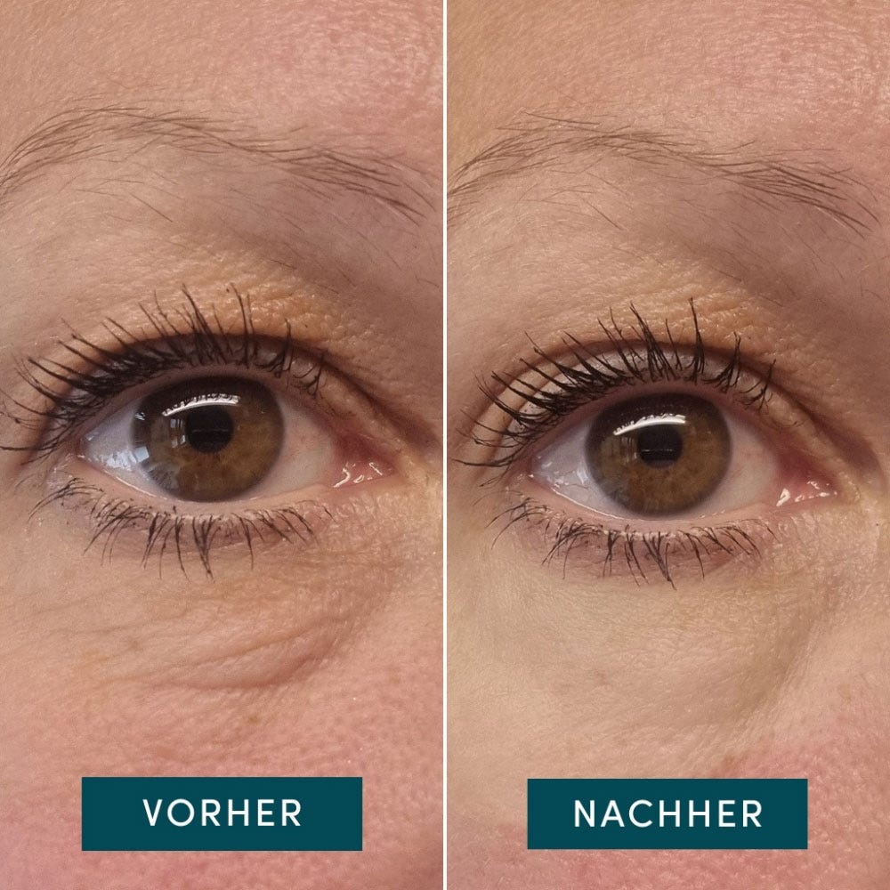 APRICOT Wiederverwendbare Augen-Schläfen Pads mit Hexapeptid-Technologie