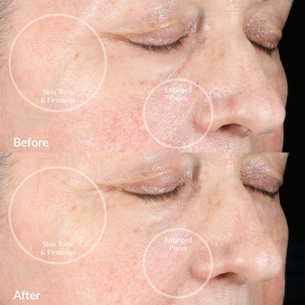 PMD Beauty Clean Pro Jade Cream