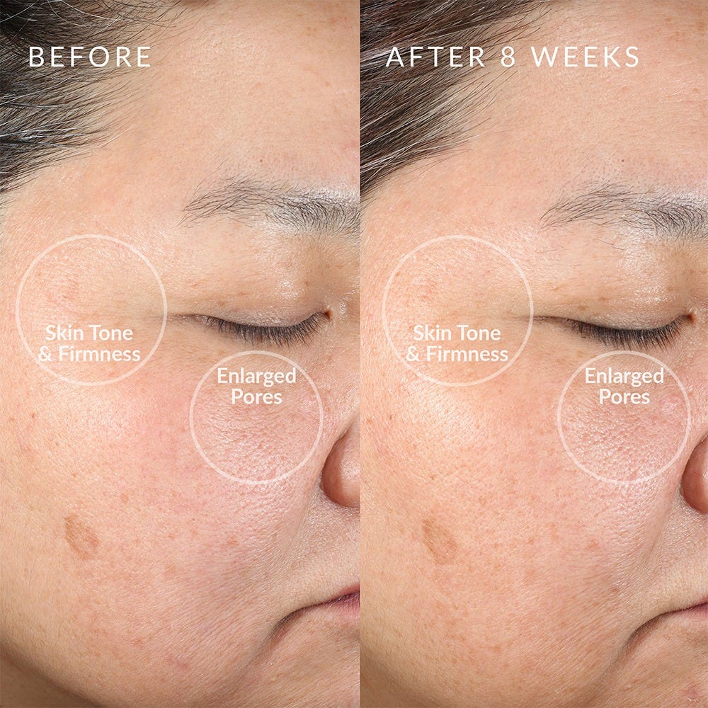 PMD Beauty Clean Redvolution