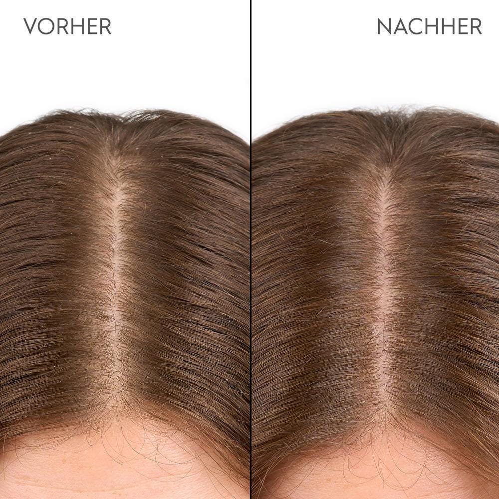 Kerasilk Feuchtigkeitsspendende Kopfhautdrops100 ml