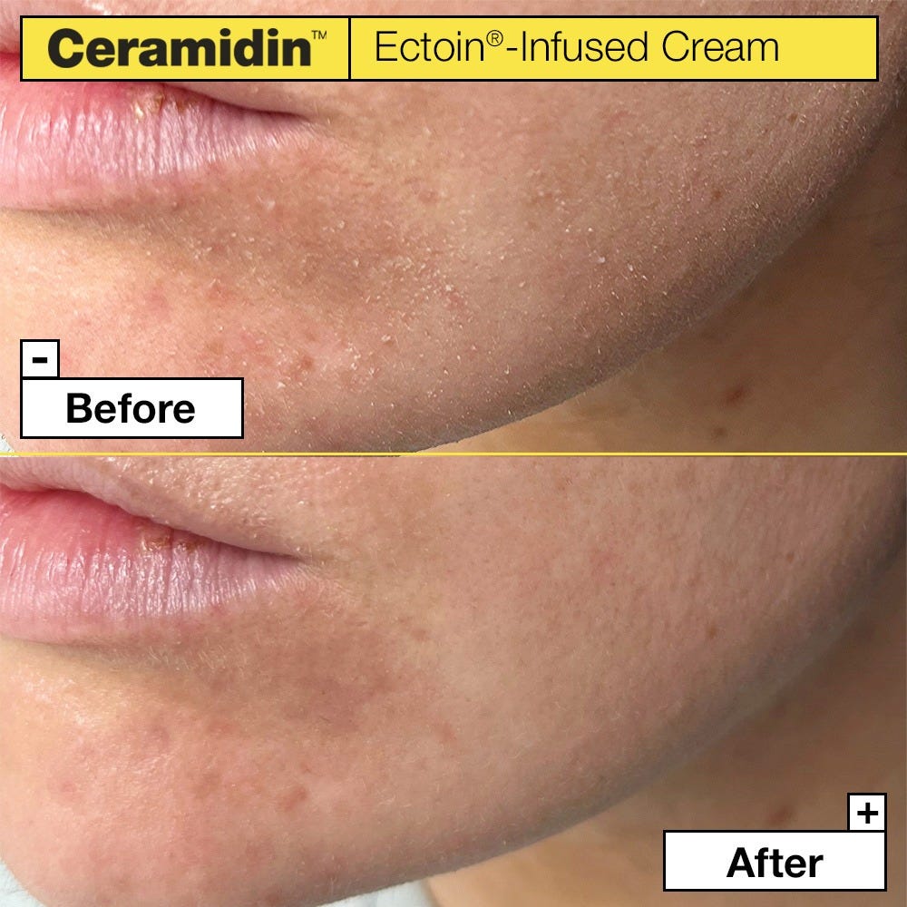 Dr.Jart+ Ceramidin Ectoin-Infused Cream 50 ml